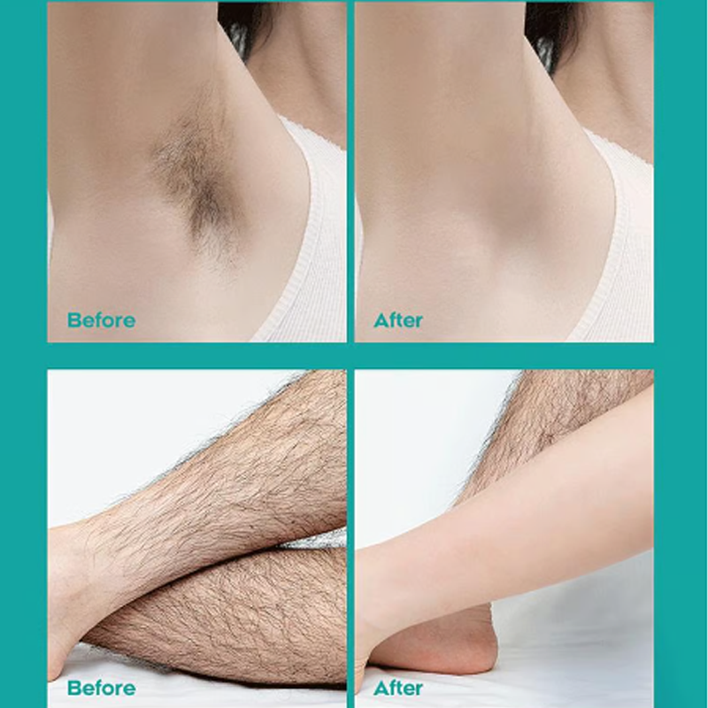🧴✨ 2 KAUFEN, 1 GRATIS! 🌿💖 Schmerzfrei & sanft: Haarentfernungscreme mit Aloe Vera – seidig glatte Haut in 8 Minuten, perfekt für empfindliche Haut.