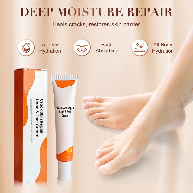 Hand- und Fußcreme zur Reparatur rissiger Haut
