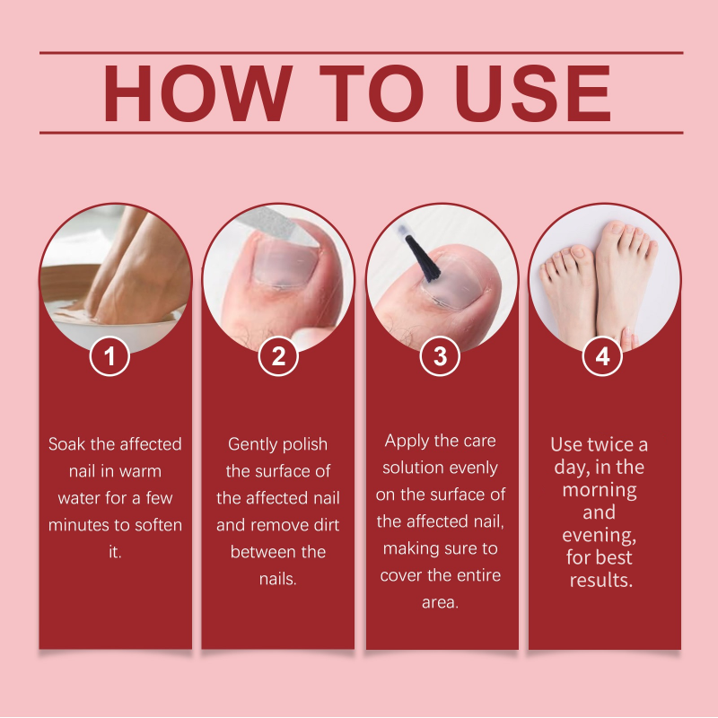 🔥Zeitlich begrenztes Weihnachtsangebot: 57 % RABATT!!!🔥 Nagel-Reparaturessenz für geschädigte Nägel