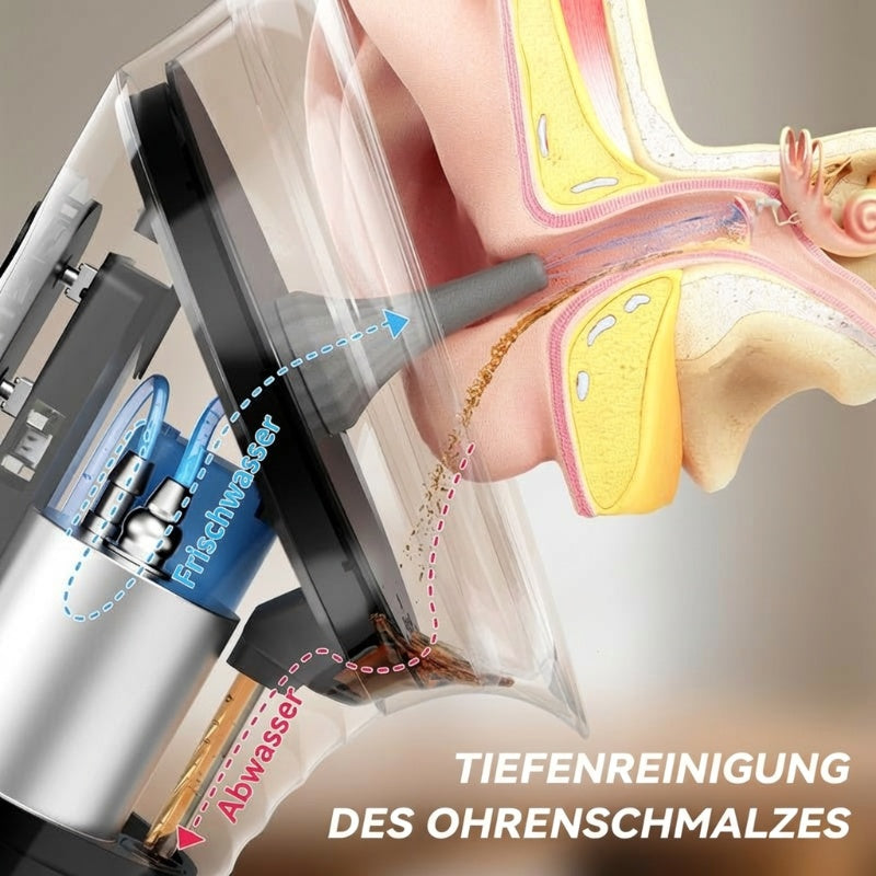 Elektrisches Ohrenspülgerät – 5-Stufen Einstellbar für Effektive Reinigung des Ohrkanals zu Hause