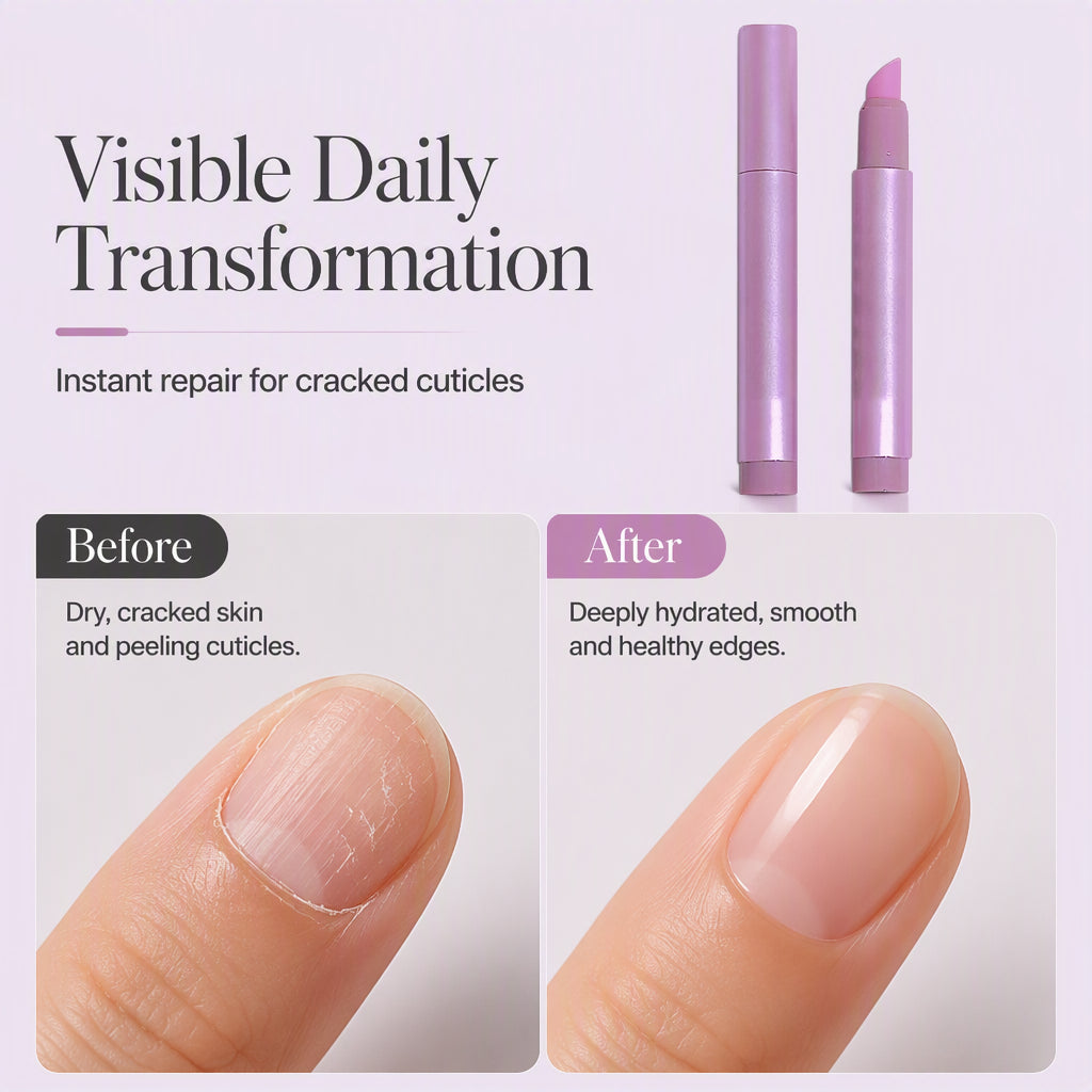 ⏰🎉Zeitlich begrenzt: 1 kaufen, 1 gratis!🎁💅Tragbarer Nagelpflege-Essenzstift